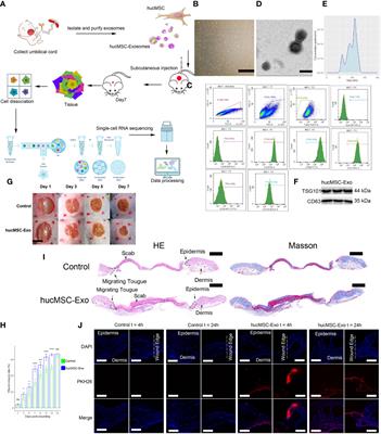 Human umbilical cord mesenchymal stem cell-derived exosomes promote murine skin wound healing by neutrophil and macrophage modulations revealed by single-cell RNA sequencing